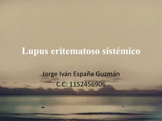 Lupus eritematoso sistémico
Jorge Iván España Guzmán
C.C: 1152456906
 