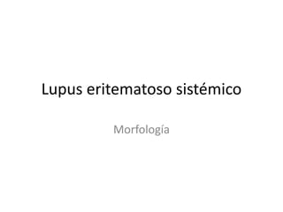 Lupus eritematoso sistémico 
Morfología 
 