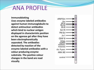 LUPUS ERITOMATOSUS SISTEMIK.ppt