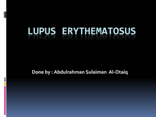 LUPUS ERYTHEMATOSUS Done by : AbdulrahmanSulaiman  Al-Otaiq 