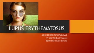 LUPUS ERYTHEMATOSUS
ACHU EDISON PUSHPAKUMARI
4th Year Medical Student
BSMU Chernivtsi Ukraine
 