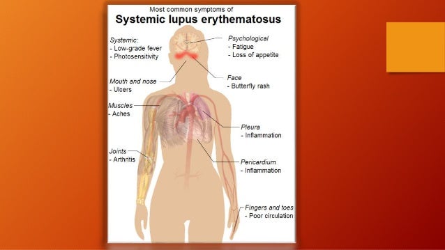 How do you lose chest fat picture 9