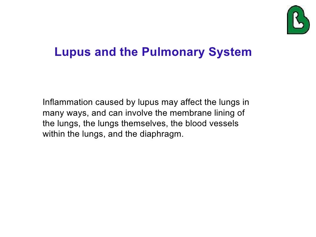 Lupus and the Lungs by Dr. Gilda DiazFuentes