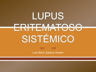 LUPUS ERITEMATOSO SISTÉMICO Luis Mario Salazar Astrain 
