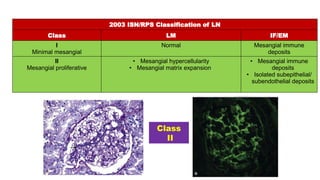 Systemic lupus nephritis or Lupus Nephritis.pptx