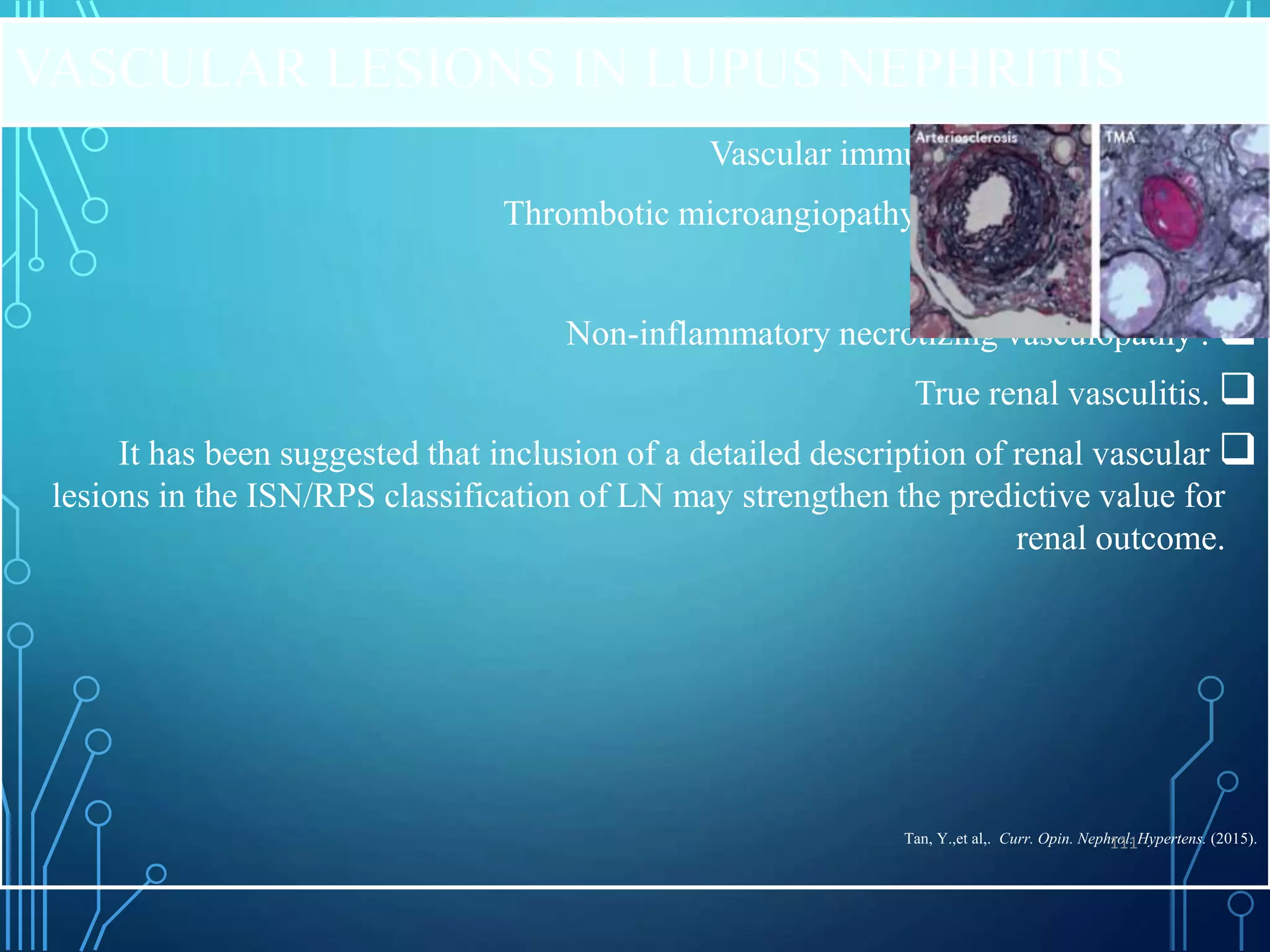 VASCULAR LESIONS IN LUPUS NEPHRITIS

Vascular immune complex deposits.

Thrombotic microangiopathy,(upto30% incidence)

Arteriosclerosis.

Non-inflammatory necrotizing vasculopathy .

True renal vasculitis.

It has been suggested that inclusion of a detailed description of renal vascular
lesions in the ISN/RPS classification of LN may strengthen the predictive value for
renal outcome.
Tan, Y.,et al,. Curr. Opin. Nephrol. Hypertens. (2015).
111
 