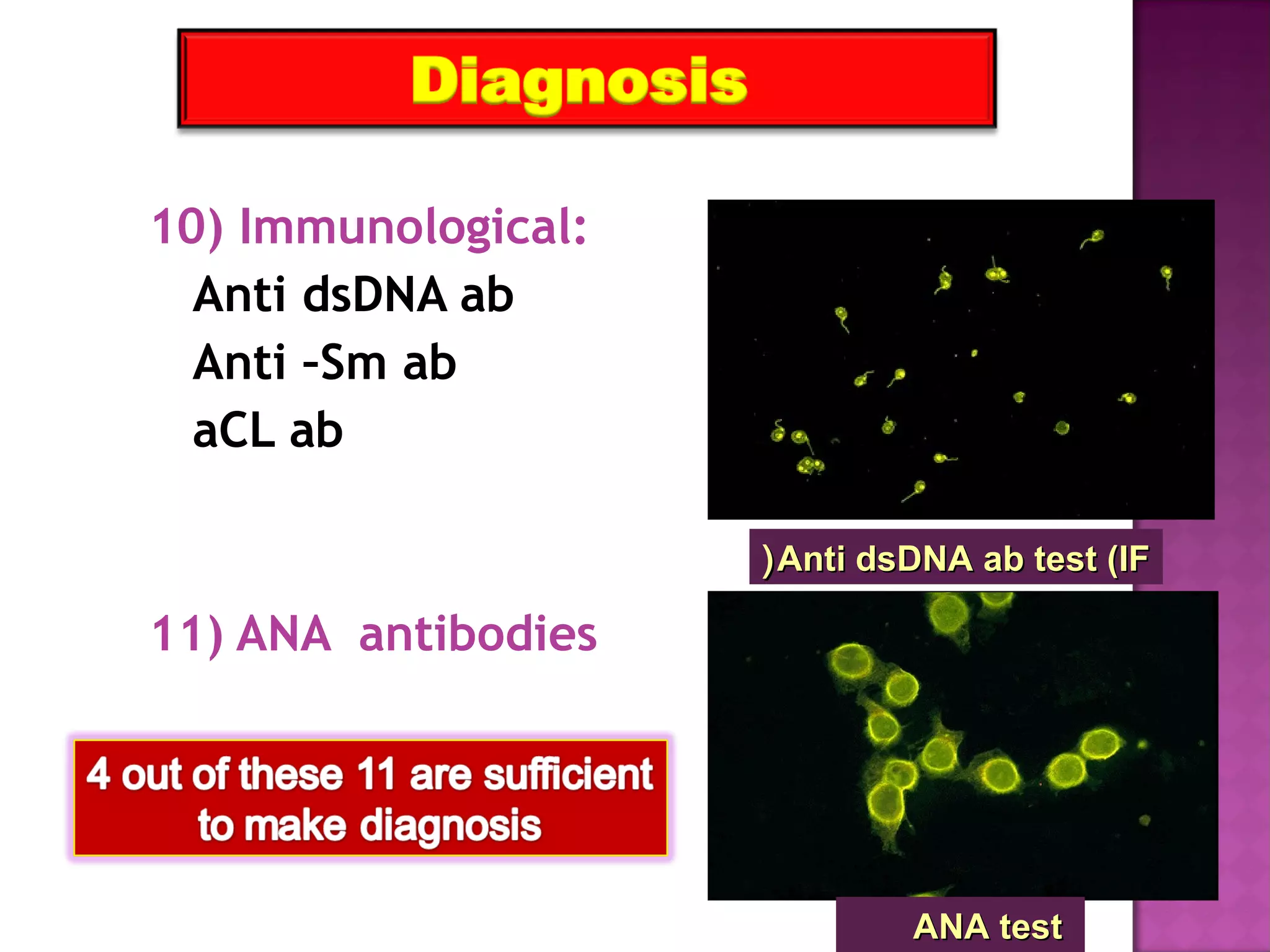 10) Immunological:
Anti dsDNA ab
Anti –Sm ab
aCL ab
11) ANA antibodies
ANA testANA test
Anti dsDNA ab test (IFAnti dsDNA ab test (IF((
 