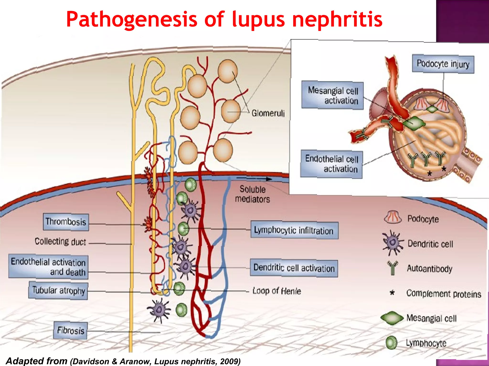 Pathogenesis of lupus nephritis
Adapted from (Davidson & Aranow, Lupus nephritis, 2009)
 
