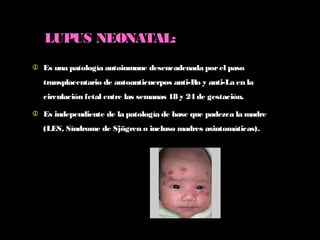 LUPUS NEONATAL:
 Es una patología autoinmune desencadenada porel paso
transplacentario de autoanticuerpos anti-Ro y anti-La en la
circulación fetal entre las semanas 18 y 24 de gestación.
 Es independiente de la patología de base que padezca la madre
(LES, Síndrome de Sjögren o incluso madres asintomáticas).
 