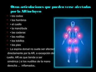 Otras articulaciones que pueden verse afectadas
porla ARincluyen
 • los codos
 • los hombros
 • el cuello
 • la mandíbula
 • las caderas
 • las rodillas
 • los tobillos
 • los pies
 La espina dorsal no suele ser afectada
directamente por la AR, a excepción del
cuello. AR es que tiende a ser
simétrica ( si los nudillos de la mano
derecha ... inflamados,
 