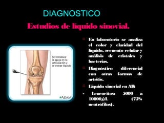 Estudios de líquido sinovial.Estudios de líquido sinovial.
 En laboratorio se analiza
el color y claridad del
líquido, recuento celular y
análisis de cristales y
bacterias.
 Diagnóstico diferencial
con otras formas de
artritis.
 Liquido sinovial en AR:
- Leucocitos: 5000 a
10000/μL (75%
neutrófilos).
DIAGNOSTICO
 