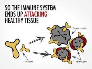 Systemic Lupus: An Overview