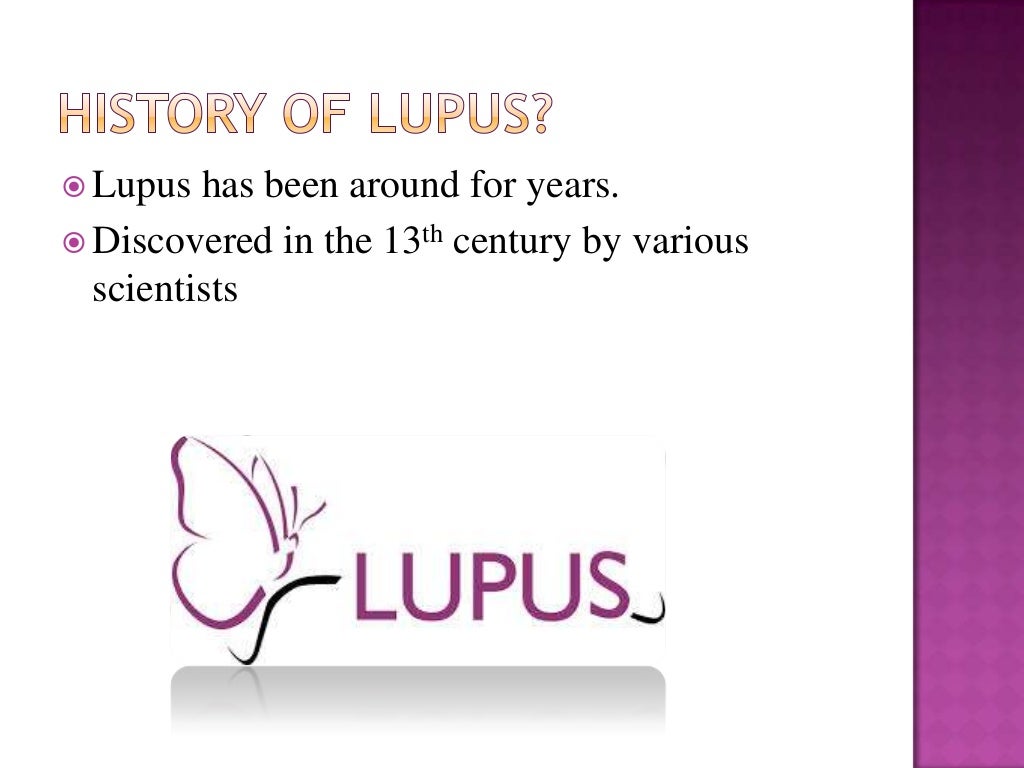 Lupus diagnosis picture