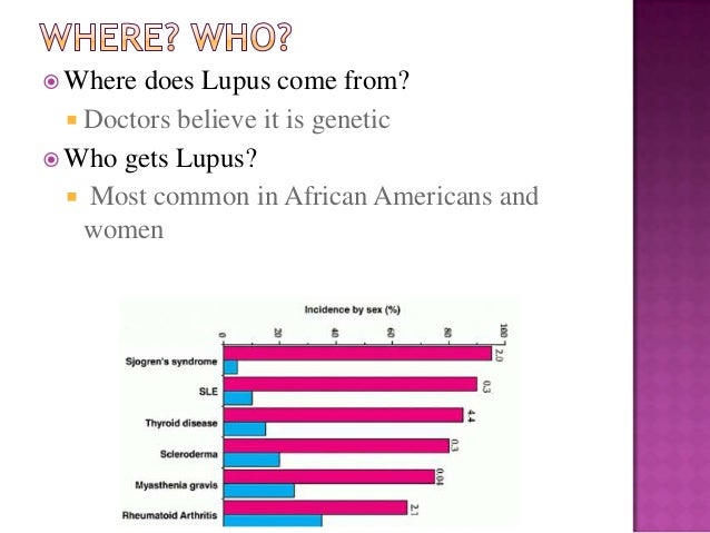 Lupus in the brain life expectancy image
