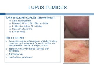 MANIFESTACIONES CLINICAS (características):
 Areas fotoexpuestas
 Fotosensibilidad: UVA, UVB, luz visible
 Incidencia máxima: 30 - 40 años
 Predominio femenino
 Raro en niños
Tipo de lesiones:
 Enrojecimiento, inflamación, protuberancias,
manchas urticariales en forma de anillo, no
descamación, curan sin dejar cicatriz
 Superficie lisa y brillante, bordes bien
definidos
 Asintomáticas
 Involución espontánea
LUPUS TUMIDUS
 