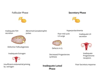 Poor Secretory response
Inadequate Luteal
Phase
Follicular Phase Secretory Phase
Inadequate FSH
secretion
Abnormal Gonadotrophin
pulses
Defective Folliculogenesis
Inadequate Estrogen
Insufficient endometrial priming
by estrogen
Poor mid cycle
LH surge
Hyperprolactinemia
Inadequate LH
secretion
Inadequate
Progesterone
receptors
Defects in CL
Decreased Progesterone
synthesis
 