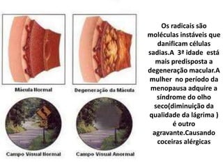 Os radicais são moléculas instáveis que danificam células sadias.A  3ª idade  está mais predisposta a degeneração macular.A mulher  no período da menopausa adquire a síndrome do olho seco(diminuição da qualidade da lágrima ) é outro agravante.Causando coceiras alérgicas