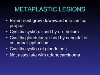 METAPLASTIC LESIONS Brunn nest grow downward into lamina propria Cystitis cystica: lined by urothelium Cystitis glandularis: lined by cuboidal or columnar epithelium Cystitis cystica et glandularis Not associate with adenocarcinoma 