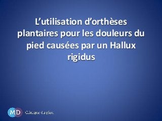 L’utilisation d’orthèses
plantaires pour les douleurs du
pied causées par un Hallux
rigidus

 