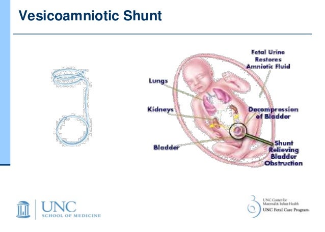 fluid amniotic how Luto fluid amniotic how Luto