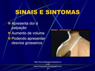 SINAIS E SINTOMAS
Apresenta dor á
palpação
Aumento de volume
Podendo apresentar
desvios grosseiros
http://traumatologiaeortopedia.co
m &
www.ortopediabrasil.blogspot.com
.br
 
