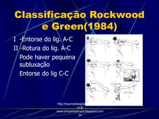Classificação Rockwood
e Green(1984)
I -Entorse do lig. A-C
II -Rotura do lig. A-C
Pode haver pequena
subluxação
Entorse do lig C-C
http://traumatologiaeortopedia.co
m &
www.ortopediabrasil.blogspot.com
.br
 