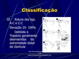 Classificação
III Rotura dos ligs.
A-C e C-C
Elevação 25- 100%
Deltóide e
Trapézio geralmente
desinseridos da
extremidade distal
da clavícula
http://traumatologiaeortopedia.co
m &
www.ortopediabrasil.blogspot.com
.br
 