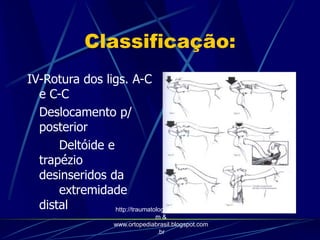 Classificação:
IV-Rotura dos ligs. A-C
e C-C
Deslocamento p/
posterior
Deltóide e
trapézio
desinseridos da
extremidade
distal http://traumatologiaeortopedia.co
m &
www.ortopediabrasil.blogspot.com
.br
 