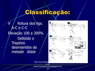 Classificação:
V Rotura dos ligs.
A-C e C-C
Elevação 100 a 300%
Deltóide e
Trapézio
desinseridos da
metade distal
http://traumatologiaeortopedia.co
m &
www.ortopediabrasil.blogspot.com
.br
 