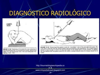 DIAGNÓSTICO RADIOLÓGICO
http://traumatologiaeortopedia.co
m &
www.ortopediabrasil.blogspot.com
.br
 