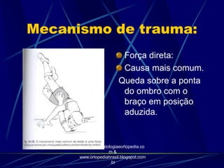 Mecanismo de trauma:
Força direta:
Causa mais comum.
Queda sobre a ponta
do ombro com o
braço em posição
aduzida.
http://traumatologiaeortopedia.co
m &
www.ortopediabrasil.blogspot.com
.br
 