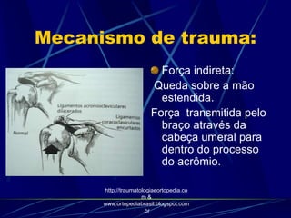 Mecanismo de trauma:
Força indireta:
Queda sobre a mão
estendida.
Força transmitida pelo
braço através da
cabeça umeral para
dentro do processo
do acrômio.
http://traumatologiaeortopedia.co
m &
www.ortopediabrasil.blogspot.com
.br
 