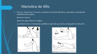 Maniobra de Allis
 Para lux. Posteriores. Tracción constante en la línea del fémur, asociada a contratación
estabilizando la pelvis.
- Rotación interna
- Aducción para reducir la cadera
- La presencia de un chasquido audible es signo de que se ha conseguido la reducción
 