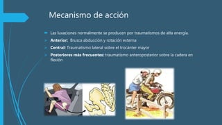 Mecanismo de acción
 Las luxaciones normalmente se producen por traumatismos de alta energía.
 Anterior: Brusca abducción y rotación externa
 Central: Traumatismo lateral sobre el trocánter mayor
 Posteriores más frecuentes: traumatismo anteroposterior sobre la cadera en
flexión
 