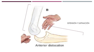 EXTENSIÓN Y SUPINACIÓN
 