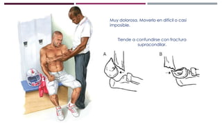 Muy dolorosa. Moverlo en difícil o casi
imposible.
Tiende a confundirse con fractura
supracondilar.
 