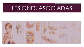 LESIONES ASOCIADAS
 