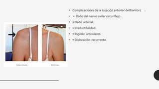 • Complicaciones de la luxación anterior del hombro :
• • Daño del nervio axilar circunflejo.
• • Daño arterial.
• • Irreductibilidad.
• • Rigidez articulares.
• • Dislocación recurrente.
 