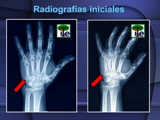 Radiografías iniciales

 