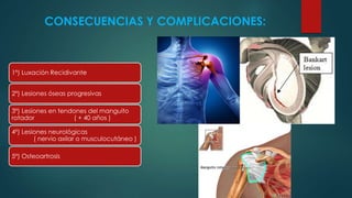 CONSECUENCIAS Y COMPLICACIONES:
1º) Luxación Recidivante
2º) Lesiones óseas progresivas
3º) Lesiones en tendones del manguito
rotador ( + 40 años )
4º) Lesiones neurológicas
( nervio axilar o musculocutáneo )
5º) Osteoartrosis
 