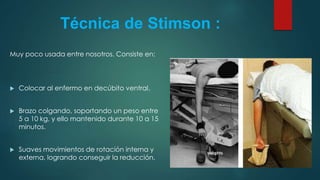 Técnica de Stimson :
Muy poco usada entre nosotros. Consiste en:
 Colocar al enfermo en decúbito ventral.
 Brazo colgando, soportando un peso entre
5 a 10 kg, y ello mantenido durante 10 a 15
minutos.
 Suaves movimientos de rotación interna y
externa, logrando conseguir la reducción.
 