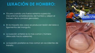 LUXACIÓN DE HOMBRO:
 Ocurre cuando una fuerza extrema supera los
mecanismos estabilizadores del hombro y alejan el
húmero de la cavidad glenoidea.
 En la mayoría dos casos se producen lesión del labio o
ligamentos del manguito.
 La luxación anterior es la mas común ( húmero
dislocado hacia adelante)
 La luxación posterior es mas común en accidentes de
transito.
 