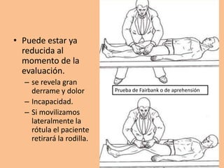 • Puede estar ya
  reducida al
  momento de la
  evaluación.
  – se revela gran
    derrame y dolor        Prueba de Fairbank o de aprehensión

  – Incapacidad.
  – Si movilizamos
    lateralmente la
    rótula el paciente
    retirará la rodilla.
 
