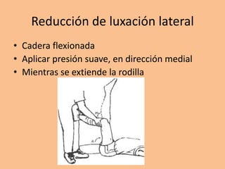 Reducción de luxación lateral
• Cadera flexionada
• Aplicar presión suave, en dirección medial
• Mientras se extiende la rodilla
 