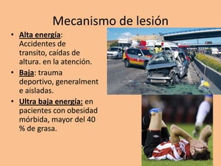 Mecanismo de lesión
• Alta energía:
  Accidentes de
  transito, caídas de
  altura. en la atención.
• Baja: trauma
  deportivo, generalment
  e aisladas.
• Ultra baja energía: en
  pacientes con obesidad
  mórbida, mayor del 40
  % de grasa.
 