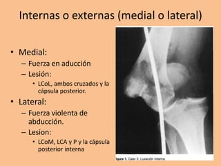 Internas o externas (medial o lateral)

• Medial:
   – Fuerza en aducción
   – Lesión:
      • LCoL, ambos cruzados y la
        cápsula posterior.
• Lateral:
   – Fuerza violenta de
     abducción.
   – Lesion:
      • LCoM, LCA y P y la cápsula
        posterior interna
 
