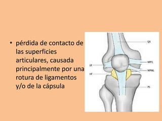 • pérdida de contacto de
  las superficies
  articulares, causada
  principalmente por una
  rotura de ligamentos
  y/o de la cápsula
 