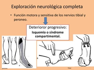 Exploración neurológica completa
          • Función motora y sensitiva de los nervios tibial y
            peroneo.

                      Deterioror progresivo:
                        Isquemia o síndrome
                          compartimental.




peroneo                                          Tibial
 