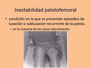 Inestabilidad patelofemoral
• condición en la que se presentan episodios de
  luxación o subluxación recurrente de la patela.
  – en la mayoría de los casos lateralmente.
 