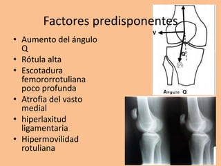 Factores predisponentes
• Aumento del ángulo
  Q
• Rótula alta
• Escotadura
  femororrotuliana
  poco profunda
• Atrofia del vasto
  medial
• hiperlaxitud
  ligamentaria
• Hipermovilidad
  rotuliana
 